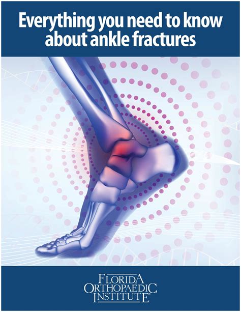 Ankle Fractures Broken Ankle Florida Orthopaedic Institute
