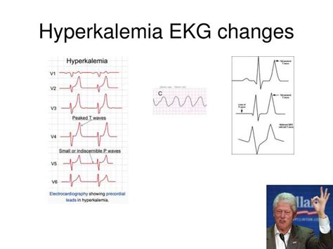 Ppt Hyperkalemia And Hypokalemia Powerpoint Presentation Id 101480