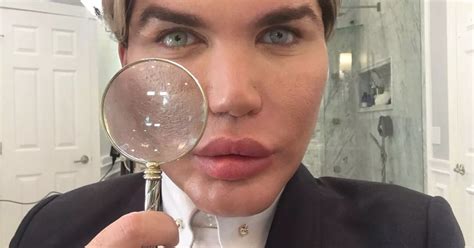 Human Ken Doll Rodrigo Alves Makes History As 51st Cosmetic Surgery Sees Him Enter The Record