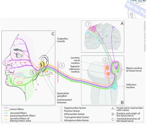 Anatomy Of The Facial Nerve Topographic Diagnosis See Text For