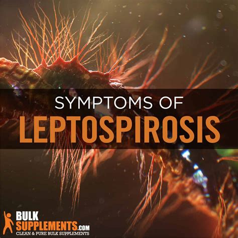 Leptospirosis Symptoms Causes And Treatment By James Denlinger