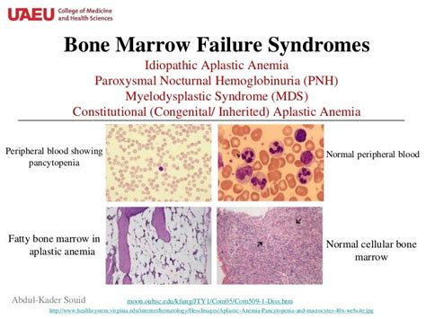Bone Marrow Failure Syndromesppt