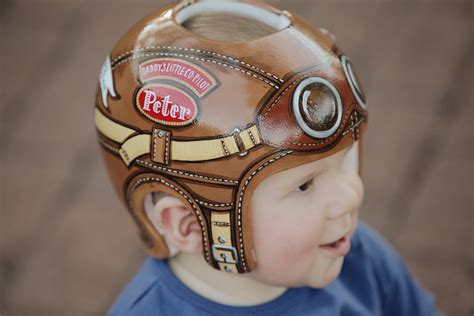The Low Down On Baby Helmets