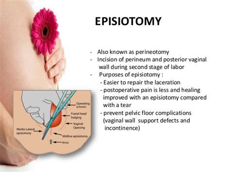 Episiotomy Healing Time Hiccups Pregnancy