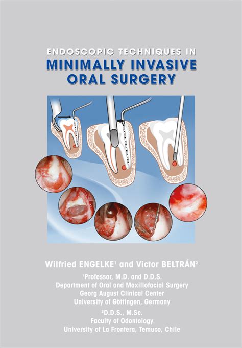 Pdf Endoscopic Techniques In Minimally Invasive Oral Surgery