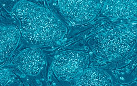 Stem Cells What And Why