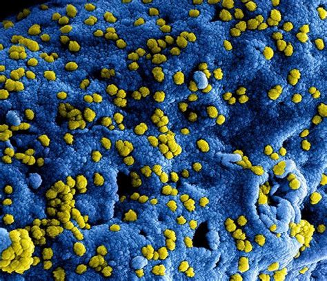 The latest news and updates on the coronavirus outbreak from cnbc's global teams in asia, europe and the u.s. Update information on the novel coronavirus