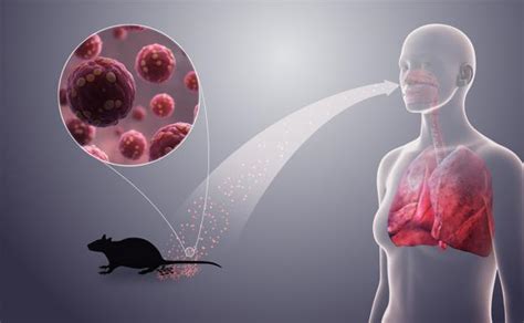 Hantaviruses are viruses passed to humans from the urine and droppings of rodents. Tras el coronavirus... Qué es el Hantavirus: síntomas y ...