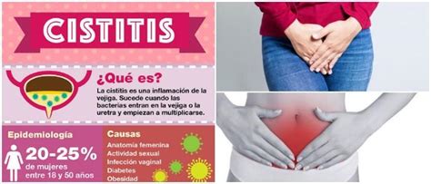 Cistitis Causas S Ntomas Y Tratamiento En Cistitis Vias Sexiz Pix