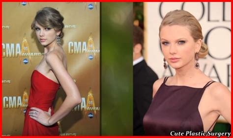 Taylor Swift Plastic Surgery Celebrities Plastic Surgery