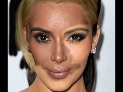 Kardashians Plastic Surgery Before And After
