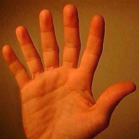 Tener seis dedos en la mano podría mejorarte la vida Noesis