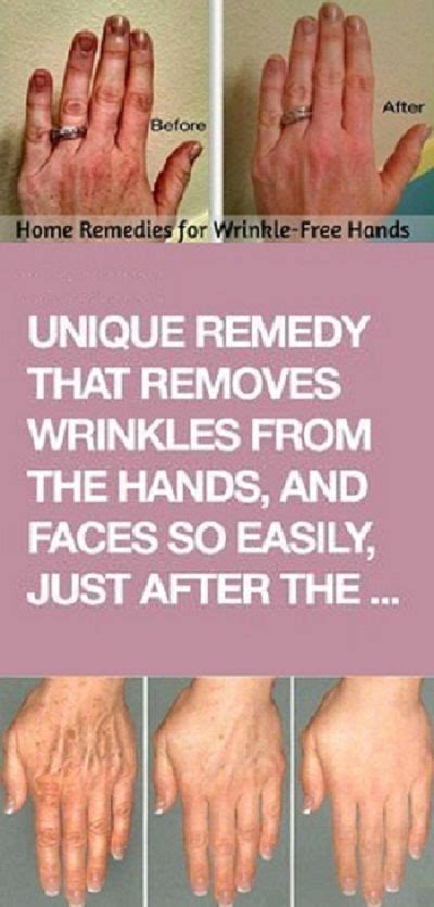 You must do these treatments daily to start to reduce wrinkles from your fingers and eventually removing the wrinkles from your hands and fingers. Unique Remedy That Removes Wrinkles From The Hands, And ...