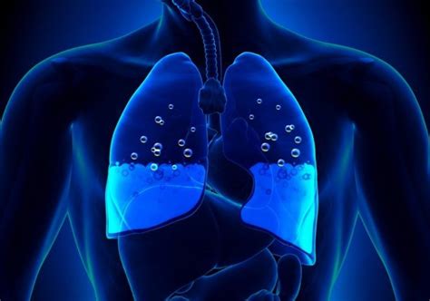 What Is Pulmonary Edemasymptoms And Causes