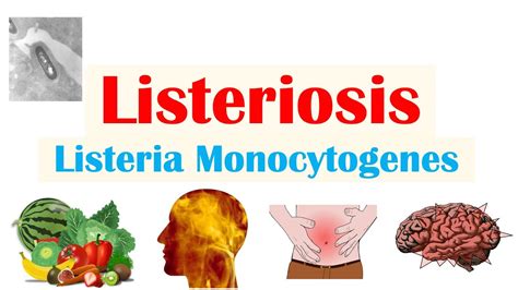 Listeria What Is Causes Diagnosis Symptoms And Treatment April