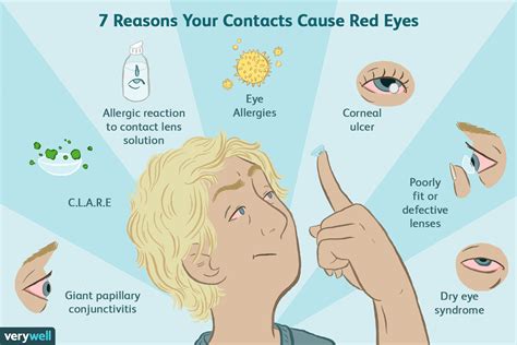Causes Of Red Eyes In Contact Wearers
