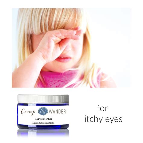 Natural Home Remedy For Itchy Eyes Camp Wander