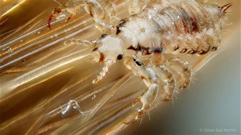 Super Head Lice Spreading Around The World Behind The News Youtube