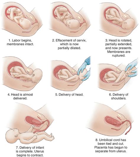 It is further divided into a passive phase which involves a progressive descent and rotation of the presenting part, and an active phase of maternal expulsive efforts. effacement clipart 20 free Cliparts | Download images on ...