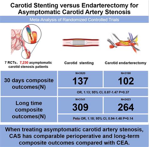 Carotid Stenting Versus Endarterectomy For Asymptomatic Carotid Artery