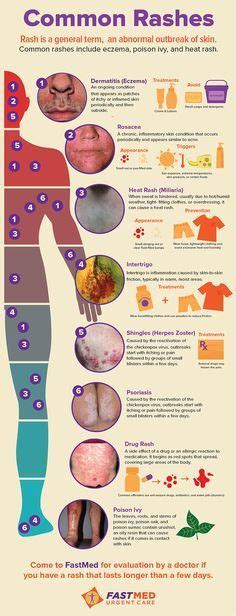 Common Rashes Infographic Skin Itch Rash Dermatology Medical