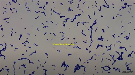 Pneumococcus And Viridans Streptococci Introduction Differentiat