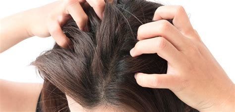 Understanding Skin Rashes Caused By Itchy Scalp Brian Williams