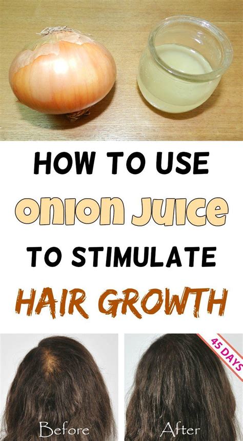 Table of contents is onion juice good for hair? Onion juice for hair, Onion juice for hair growth, Stop ...