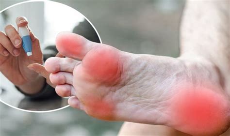 Common Diabetic Foot Problems And Their Treatment