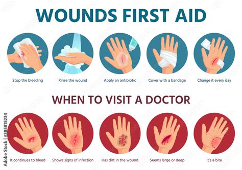 Vetor De First Aid For Wound On Skin Treatment Procedure For Bleeding