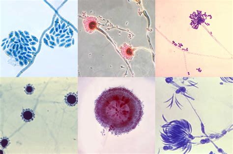 How The Fungus Among Us — And On Us — Shapes Health Shots Health