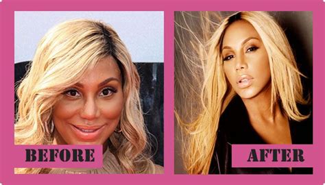 Tamar Braxton Plastic Surgery Before And After Tamar Braxton Plastic