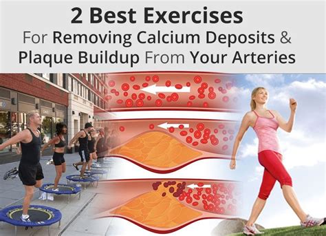Calcium in water causes the water to become hard, which makes cleaning difficult and causes calcium buildup in your appliances. Exercises For Removing Calcium Deposits & Plaque Buildup ...