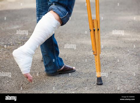 Asian Young Man On Crutches Hi Res Stock Photography And Images Alamy
