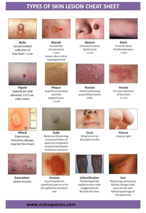 Skin Lesion Description Chart