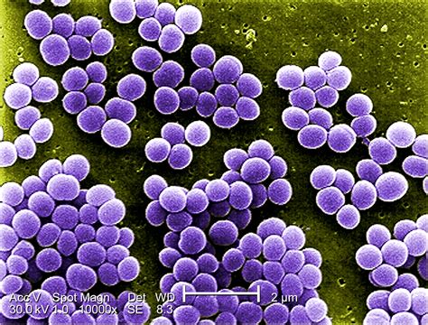 Free Picture High Magnification 10000x Strain Staphylococcus
