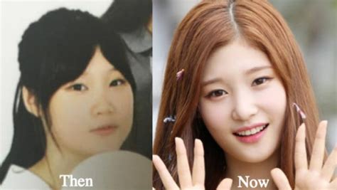 Jung Chae Yeon Plastic Surgery Before And After Photos Latest Plastic Surgery Gossip And News