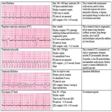 13 cardiac rhythm and dysrhythmias cheat sheet any nurse must know for the exam etsy cardiac
