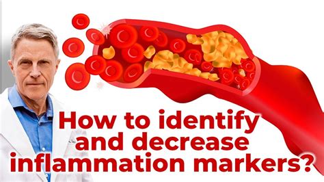 How To Identify And Decrease Inflammation Markers Youtube