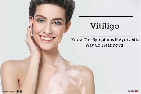 Vitiligo Know The Symptoms And Ayurvedic Way Of Treating It By Dr