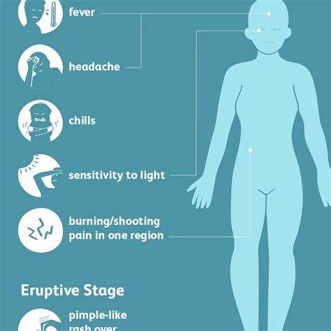 Shingles Signs Symptoms And Complications