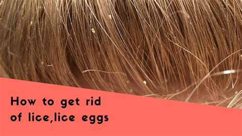 Firstly, rinse your hair with warm water and follow by applying the olive oil completely all over the scalp and hair. How to remove dead lice eggs from hair - MISHKANET.COM