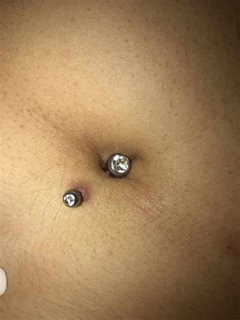 Huge sale on piercing belly now on. Is my belly button piercing rejecting? Is this normal ...