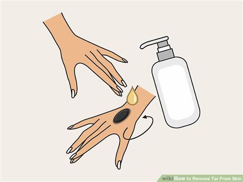 No need to worry because there are a variety of everyday products that get that tar right off. How to Remove Tar From Skin (with Pictures) - wikiHow