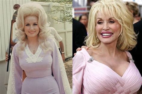 Top Celebrity Plastic Surgery Operations Gone Horribly Wrong