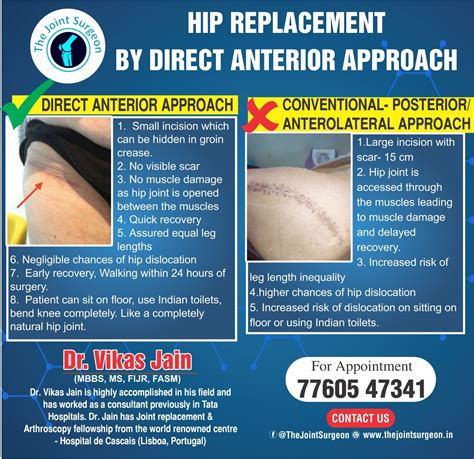 Direct Anterior Approach For Hip Replacement In Indore Direct Anterior
