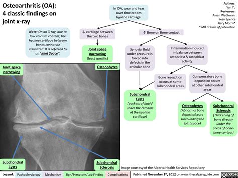 Osteoarthritis Oa X Ray Features Calgary Guide