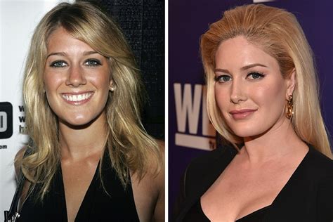 Heidi Montag I “died For A Minute” During My Plastic Surgery