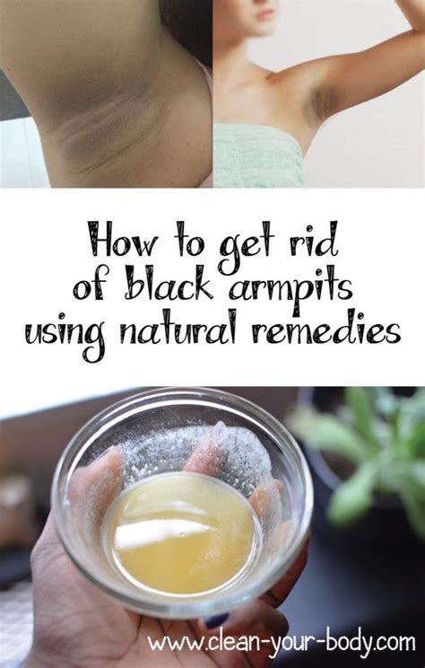 How To Get Rid Of Black Armpits Using Natural Remedies Beauty Care