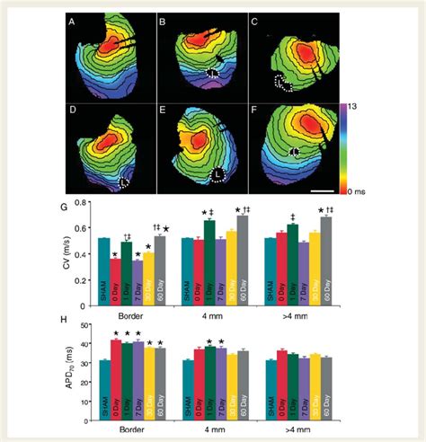 Spatial And Temporal Changes In Conduction And Apd Af